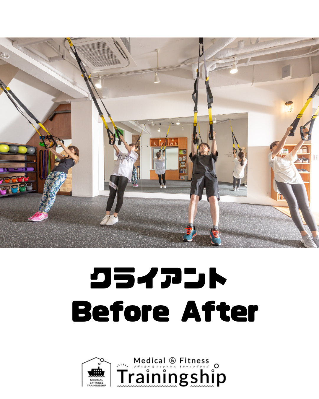 脛骨高原骨折手術後